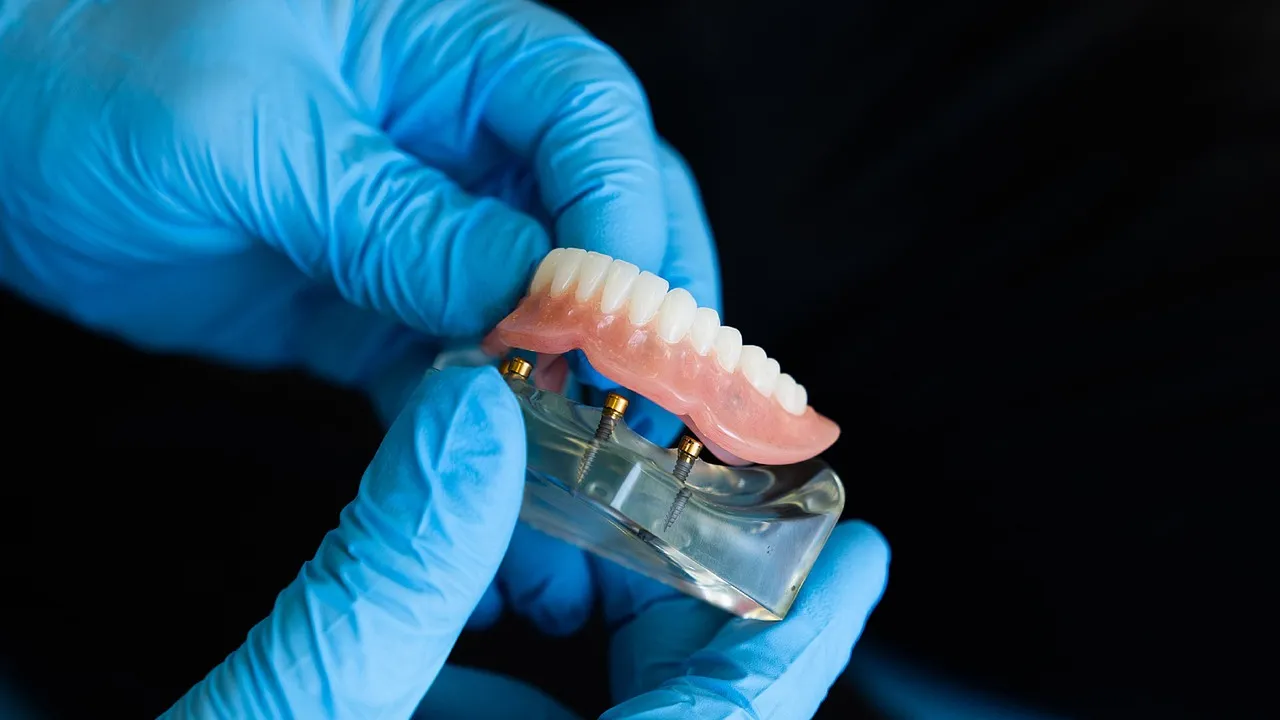Réinventer les sourires : l’expertise du prothésiste dentaire